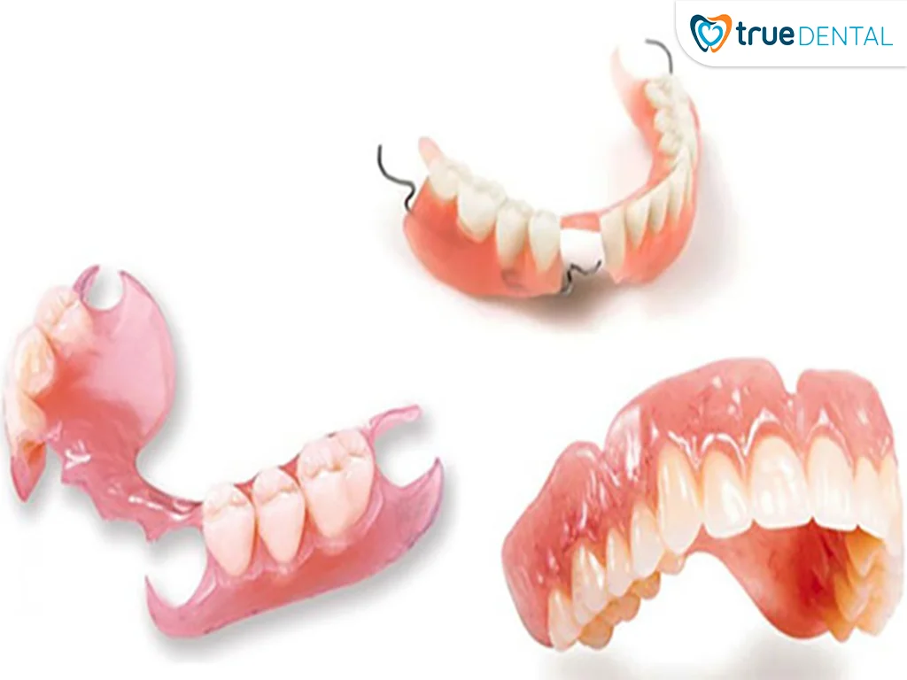 PHỤC HÌNH RĂNG BẰNG HÀM GIẢ THÁO LẮP 1 Hàm giả tháo lắp là gì?
