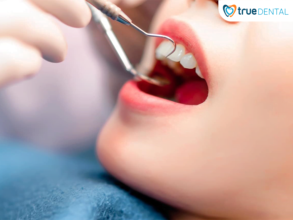 NHA KHOA TỔNG QUÁT 1 Nên thăm khám Nha khoa tổng quát