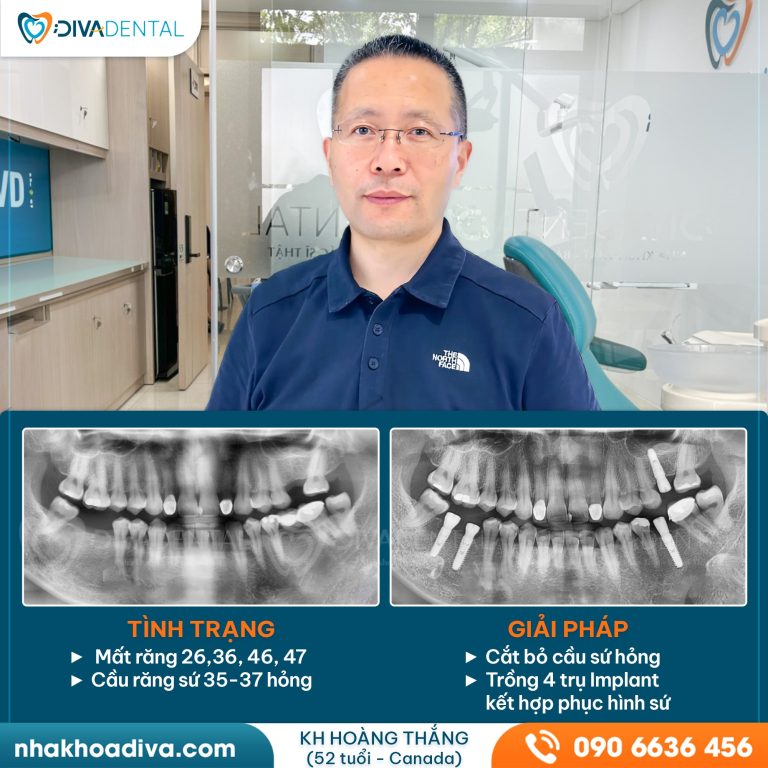 434367765 122161534616041264 7346287841509403640 n