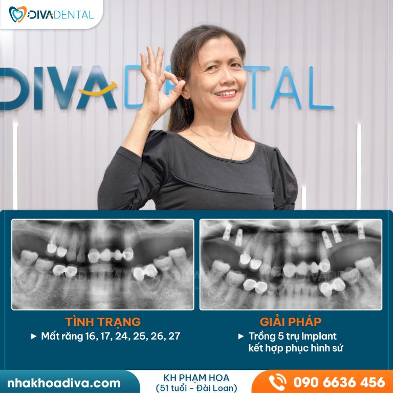 437377024 122165405870041264 2780923591085693562 n