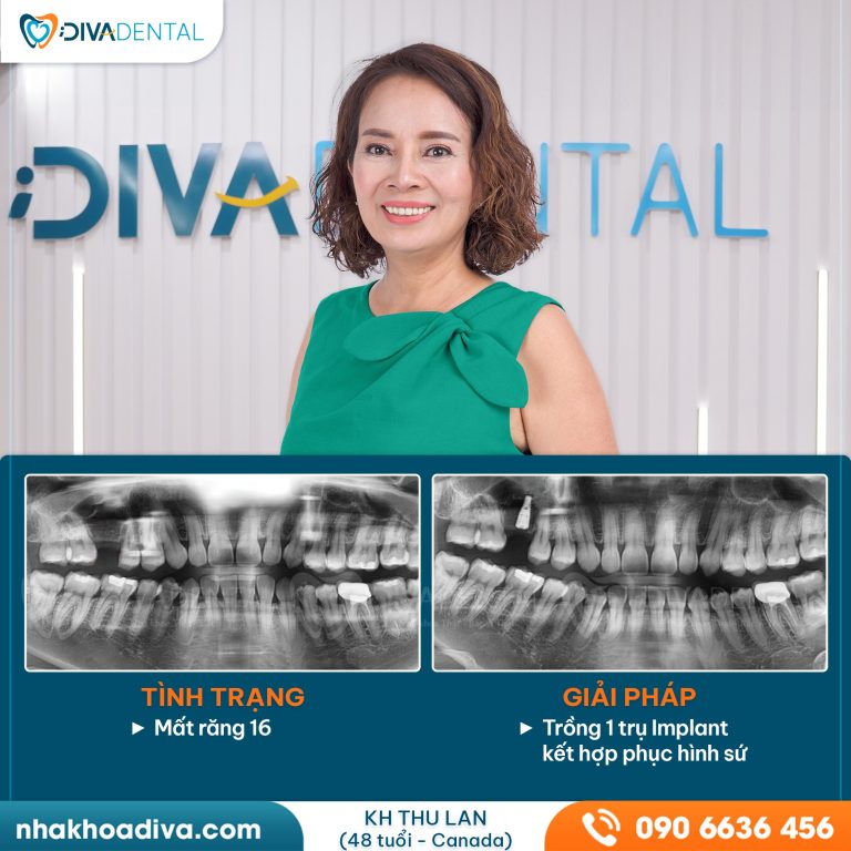 438264570 122167441082041264 6955072948508700453 n