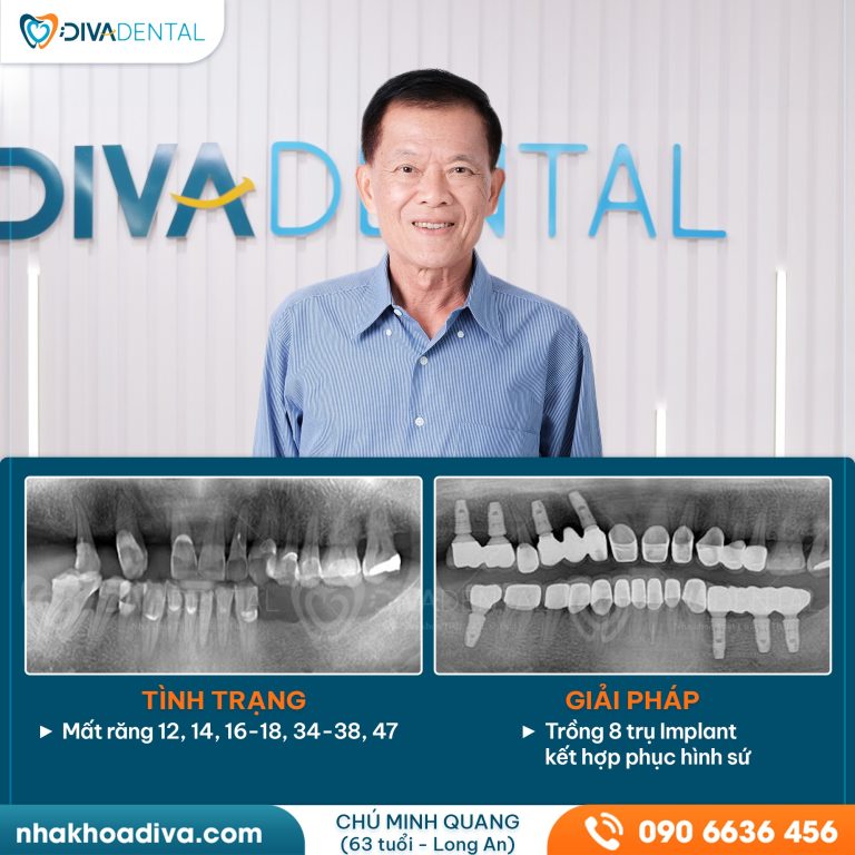 440423882 122168946206041264 8823170803721113107 n