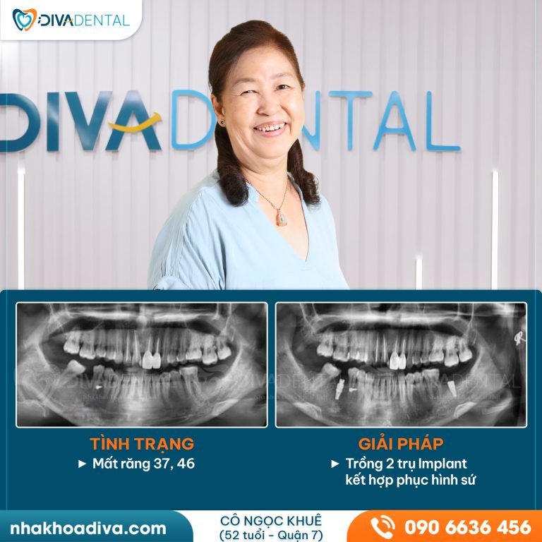 440938789 122172649226041264 7452116916207047548 n