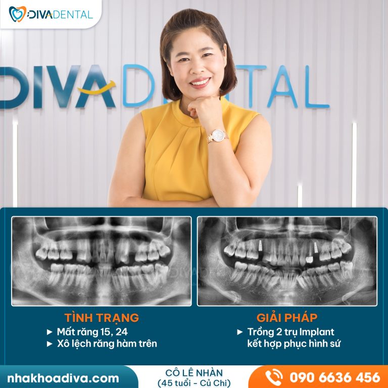 441247544 122171698472041264 5113111770481112180 n