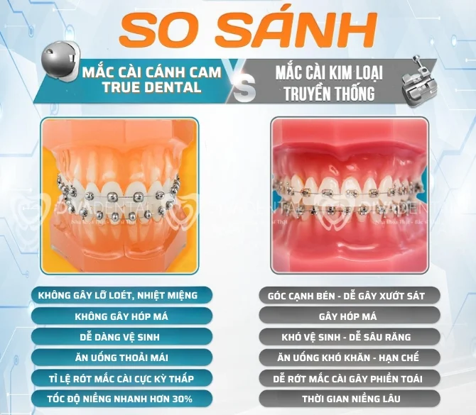Mắc Cài Cánh Cam