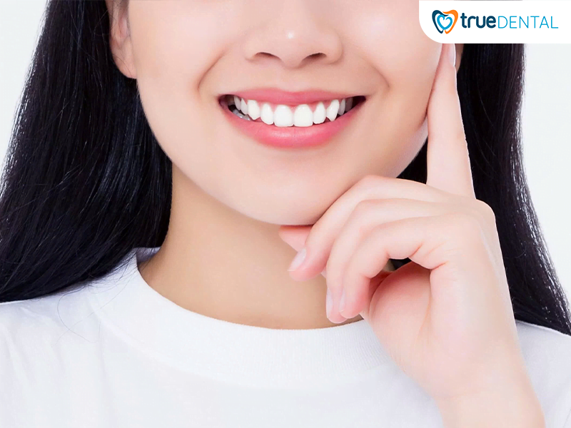 Thẩm mỹ răng sứ veneer Ultra Thin: giải pháp tối ưu cho nụ cười hoàn hảo 1 Thẩm mỹ răng sứ Veneer Ultra Thin - Giải pháp làm đẹp nụ cười an toàn