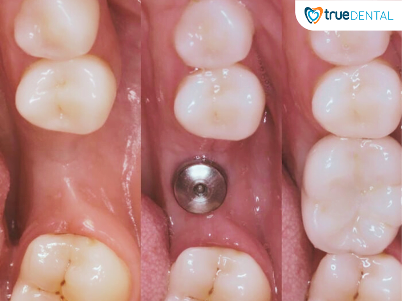 hinh 2 khong lat vat