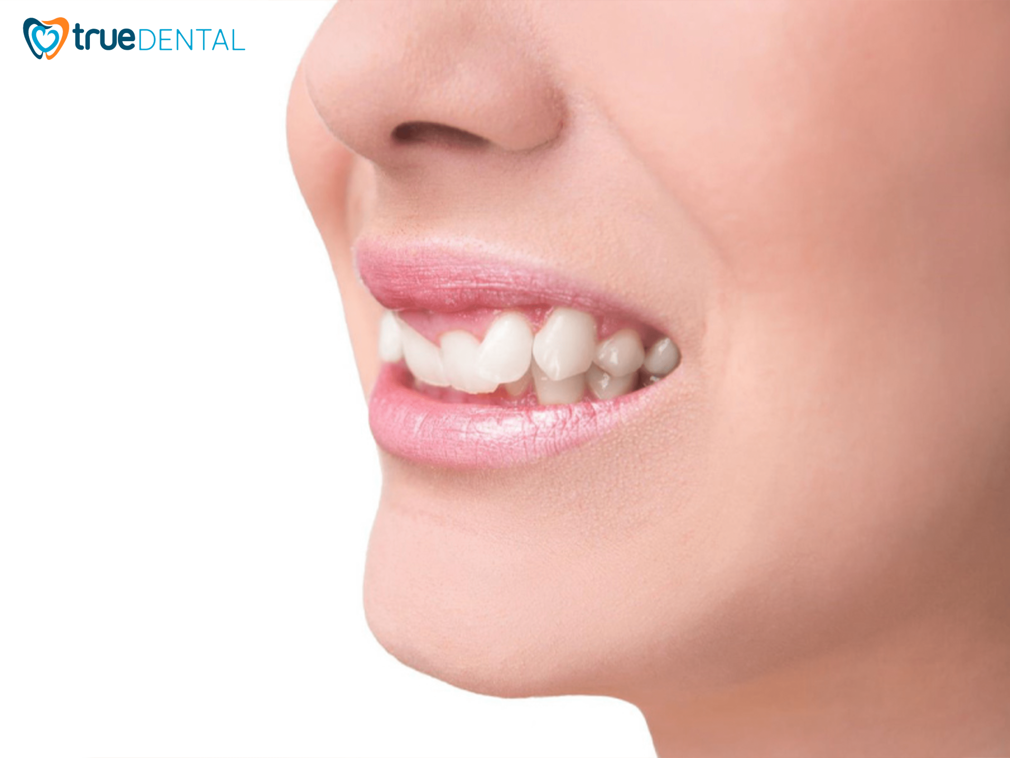 hinh 6 khap khenh nang