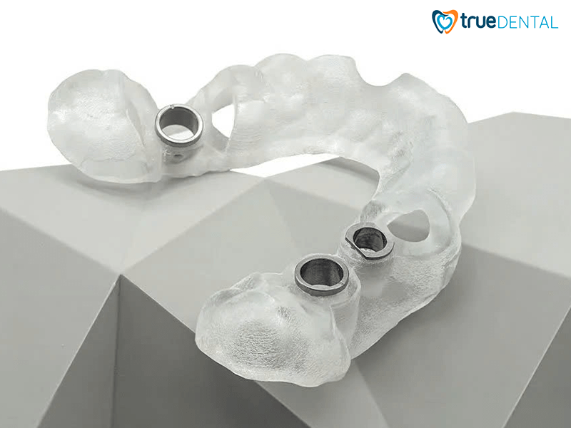 Cấy ghép Implant công nghệ sinh học GST