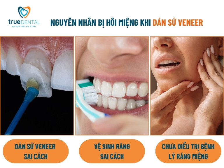nguyên nhân khiến dán sứ veneer bị hôi miệng