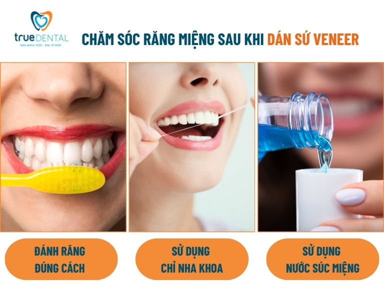 làm cách nào để dán sứ veneer không bị hôi miệng