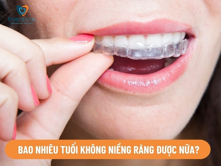 ĐỘ TUỔI NIỀNG RĂNG TỐT NHẤT LÀ KHI NÀO? GIẢI ĐÁP TỪ BÁC SĨ TRUE DENTAL 5 độ tuổi nào không thể niềng răng