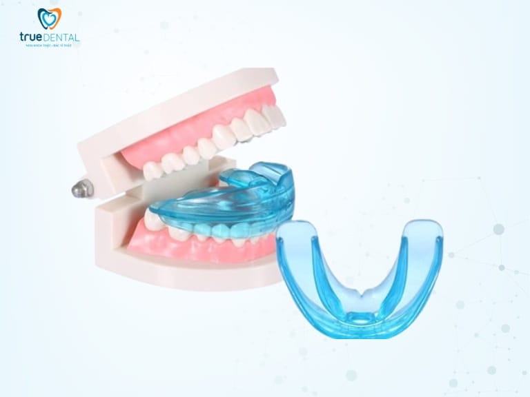 ĐỘ TUỔI NIỀNG RĂNG TỐT NHẤT LÀ KHI NÀO? GIẢI ĐÁP TỪ BÁC SĨ TRUE DENTAL 1 độ tuổi chỉnh nha cho bé