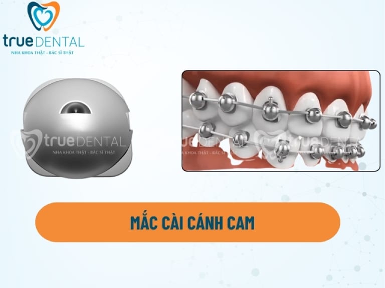 MẮC CÀI CÁNH CAM LÀ GÌ? ƯU VÀ NHƯỢC ĐIỂM CẦN BIẾT 1 mac cai canh cam