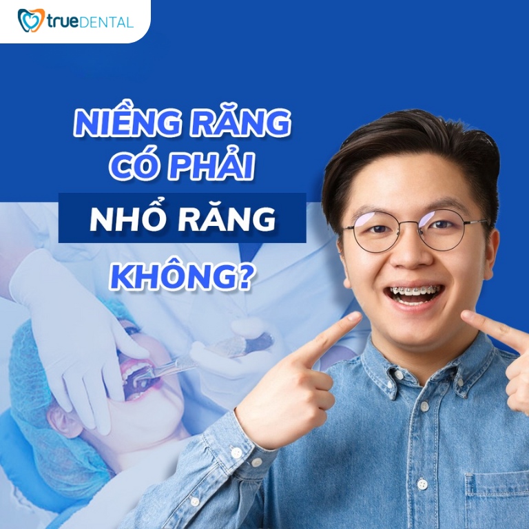 NIỀNG RĂNG CÓ PHẢI NHỔ RĂNG KHÔNG? CÓ ẢNH HƯỞNG GÌ KHÔNG? 1 niềng răng có phải nhổ răng không