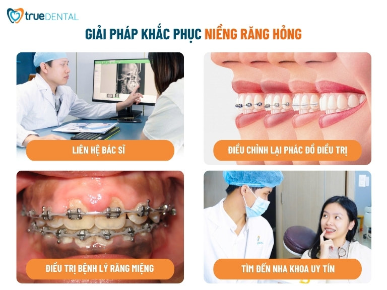 7 DẤU HIỆU NIỀNG RĂNG HỎNG BẠN CẦN BIẾT ĐỂ KHẮC PHỤC SỚM 4 giải pháp khắc phục niềng răng hỏng