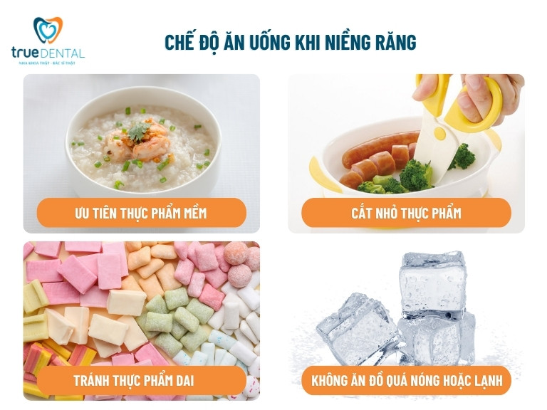 NIỀNG RĂNG SAU BAO LÂU THÌ ĐƯỢC ĂN UỐNG BÌNH THƯỜNG? 3 niềng răng sau bao lâu thì được ăn uống theo chế độ bình thường
