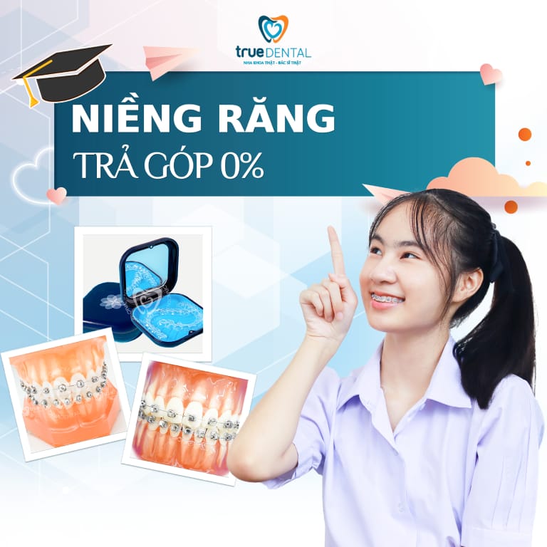 NIỀNG RĂNG TRẢ GÓP CÓ ĐƯỢC KHÔNG? THỦ TỤC THẾ NÀO? 1 niềng răng trả góp được không