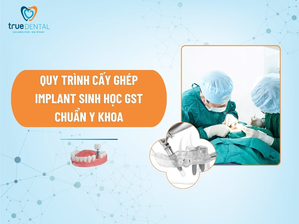 QUY TRÌNH CẤY GHÉP IMPLANT SINH HỌC GST CHUẨN Y KHOA 8 quy trình cấy ghép implant sinh học gst chuẩn y khoa