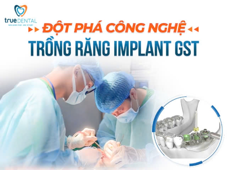 QUY TRÌNH CẤY GHÉP IMPLANT SINH HỌC GST CHUẨN Y KHOA 1 quy trình cấy ghép implant sinh học gst