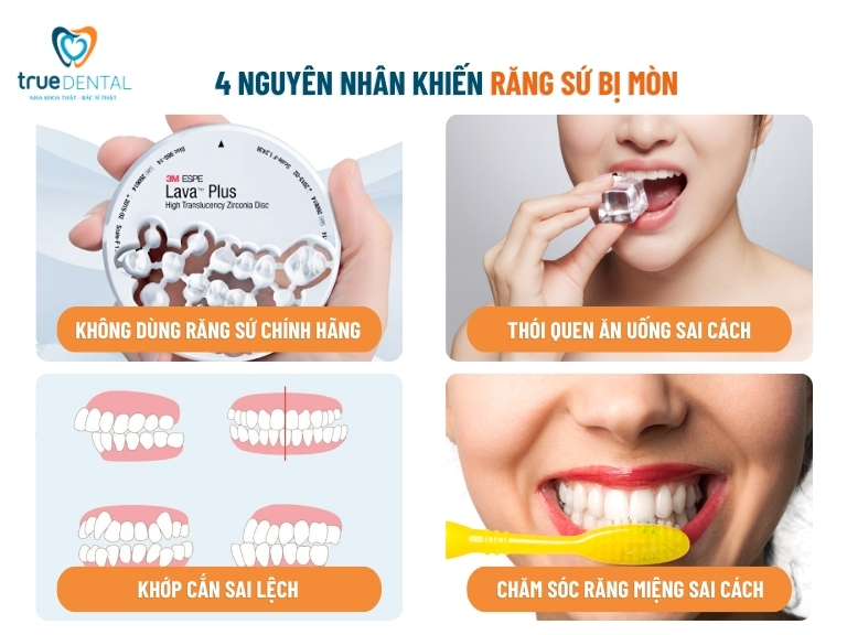 RĂNG SỨ CÓ BỊ MÒN KHÔNG? NGUYÊN NHÂN VÀ BIỆN PHÁP PHÒNG NGỪA 3 nguyên nhân khiến răng sứ bị mòn