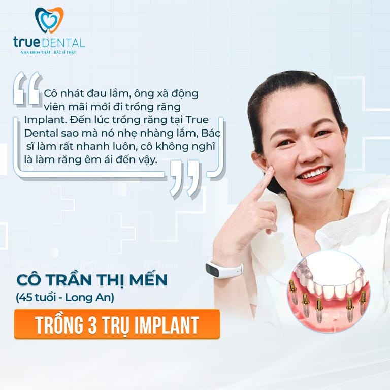TRỒNG RĂNG IMPLANT CÓ ĐAU KHÔNG? NHỮNG LƯU Ý CẦN BIẾT 4 địa chỉ cấy ghép implant không đau