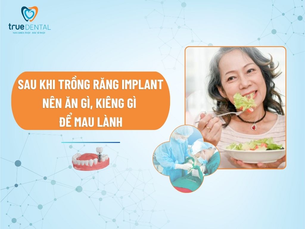 SAU KHI TRỒNG RĂNG IMPLANT NÊN ĂN GÌ, KIÊNG GÌ ĐỂ MAU LÀNH 5 SAU KHI TRỒNG RĂNG IMPLANT NÊN ĂN GÌ, KIÊNG GÌ ĐỂ MAU LÀNH