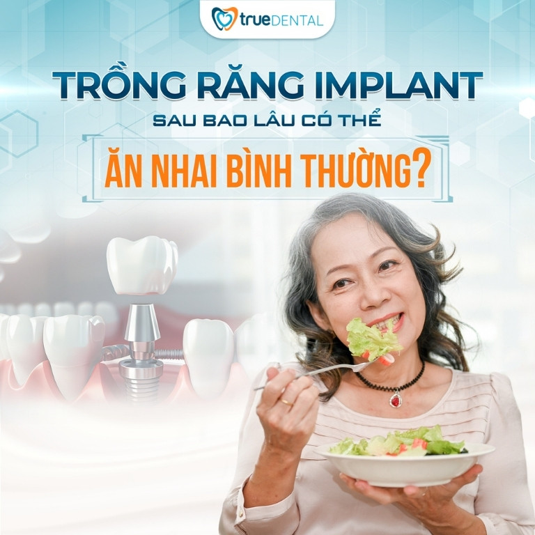 SAU KHI TRỒNG RĂNG IMPLANT NÊN ĂN GÌ, KIÊNG GÌ ĐỂ MAU LÀNH 1 trồng răng implant bao lâu có thể ăn uống bình thường