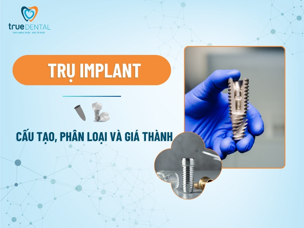 TRỤ IMPLANT: CẤU TẠO, PHÂN LOẠI VÀ GIÁ THÀNH 9 tru implant 1