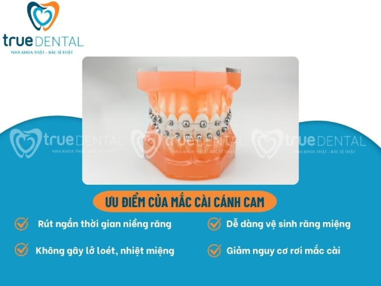 MẮC CÀI CÁNH CAM LÀ GÌ? ƯU VÀ NHƯỢC ĐIỂM CẦN BIẾT 2 uu diem mac cai canh cam