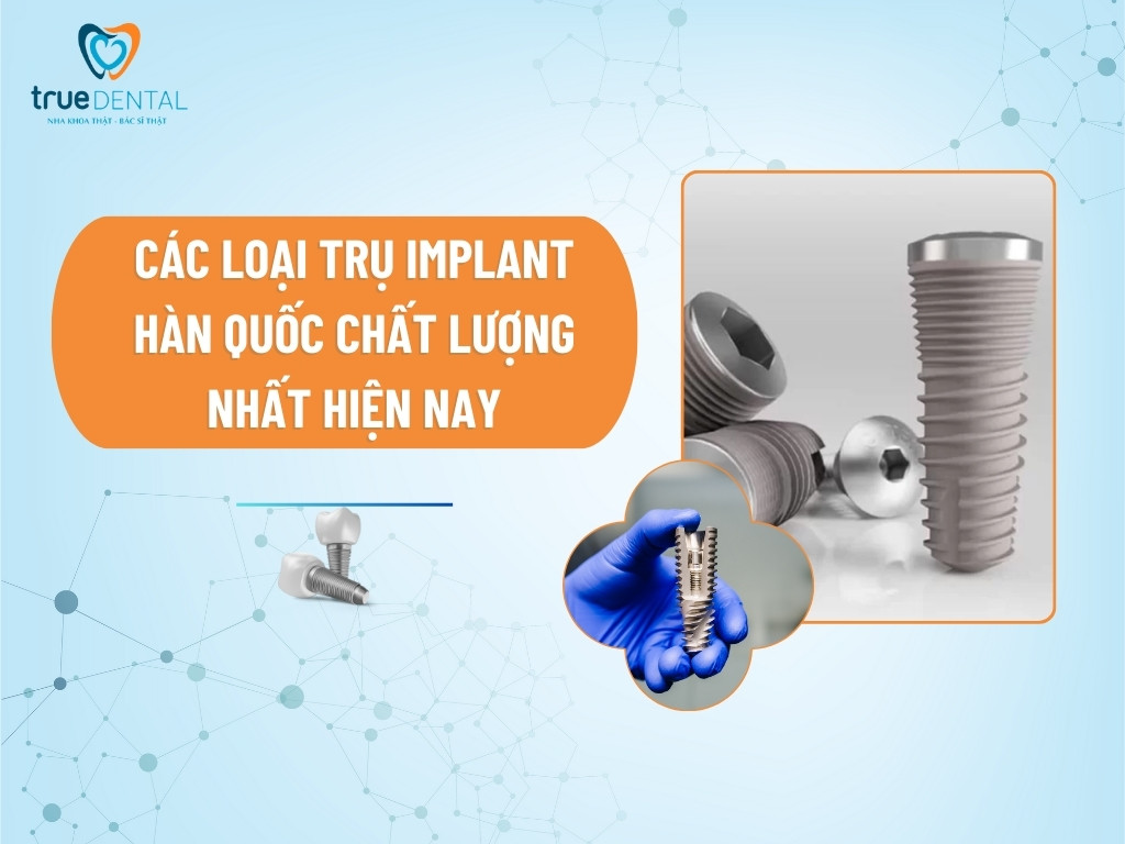 CÁC LOẠI TRỤ IMPLANT HÀN QUỐC CHẤT LƯỢNG NHẤT HIỆN NAY 4 CÁC LOẠI TRỤ IMPLANT HÀN QUỐC CHẤT LƯỢNG NHẤT HIỆN NAY