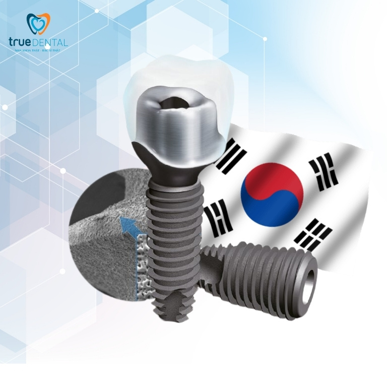 CÁC LOẠI TRỤ IMPLANT HÀN QUỐC CHẤT LƯỢNG NHẤT HIỆN NAY 1 trụ Implant Hàn Quốc