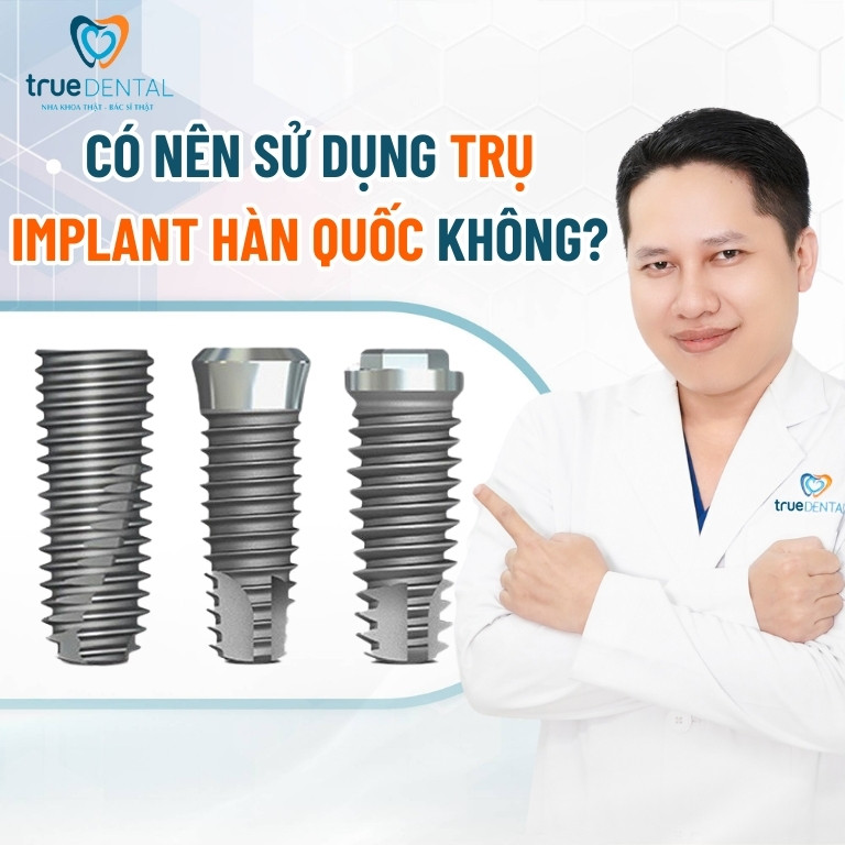 CÁC LOẠI TRỤ IMPLANT HÀN QUỐC CHẤT LƯỢNG NHẤT HIỆN NAY 4 Có nên sử dụng trụ Implant Hàn Quốc không?