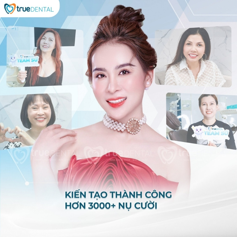 CÓ DÁN SỨ VENEER CHO RĂNG HÔ ĐƯỢC KHÔNG? TƯ VẤN TỪ BÁC SĨ TRUE DENTAL 3 địa chỉ làm thẩm mỹ răng sứ Veneer cho răng hô uy tín