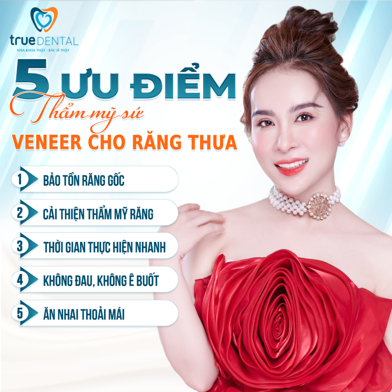 DÁN SỨ VENEER CHO RĂNG THƯA CÓ ĐƯỢC KHÔNG? CHI PHÍ BAO NHIÊU? 3 ưu điểm dán sứ Veneer cho răng thưa