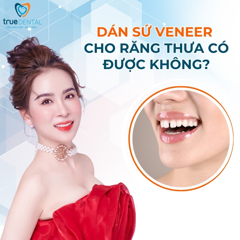 DÁN SỨ VENEER CHO RĂNG THƯA CÓ ĐƯỢC KHÔNG? CHI PHÍ BAO NHIÊU? 2 dán sứ Veneer cho răng thưa có được hay không