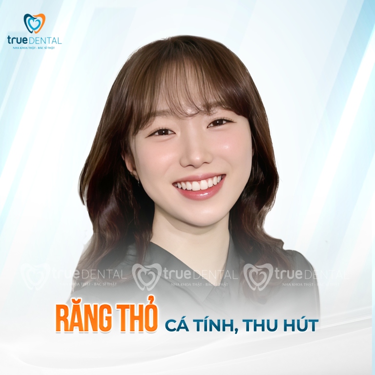 TOP 3 DÁNG RĂNG SỨ VENEER ĐẸP ĐƯỢC ƯA CHUỘNG NHẤT HIỆN NAY 1 Dáng răng sứ Veneer đẹp - Răng thỏ