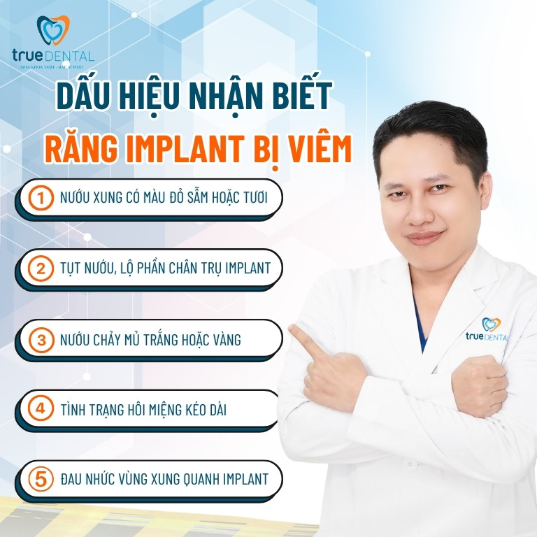 VIÊM QUANH RĂNG IMPLANT: NGUYÊN NHÂN, DẤU HIỆU VÀ CÁCH ĐIỀU TRỊ 3 dấu hiệu viêm quanh răng Implant