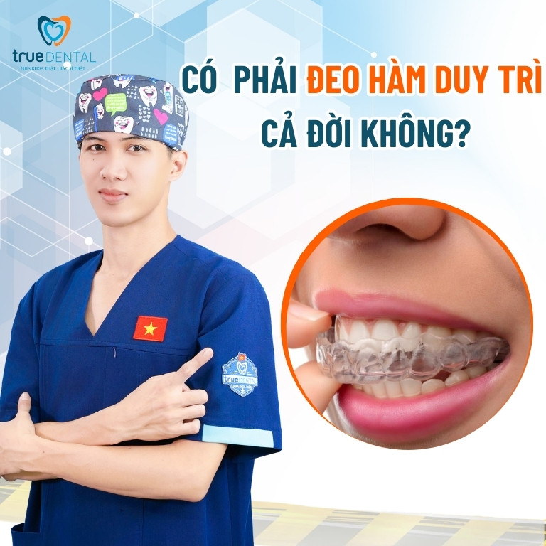 TẠI SAO PHẢI ĐEO HÀM DUY TRÌ SAU NIỀNG RĂNG? CÓ PHẢI ĐEO CẢ ĐỜI KHÔNG? 4 Có phải đeo hàm duy trì cả đời sau khi niềng răng không
