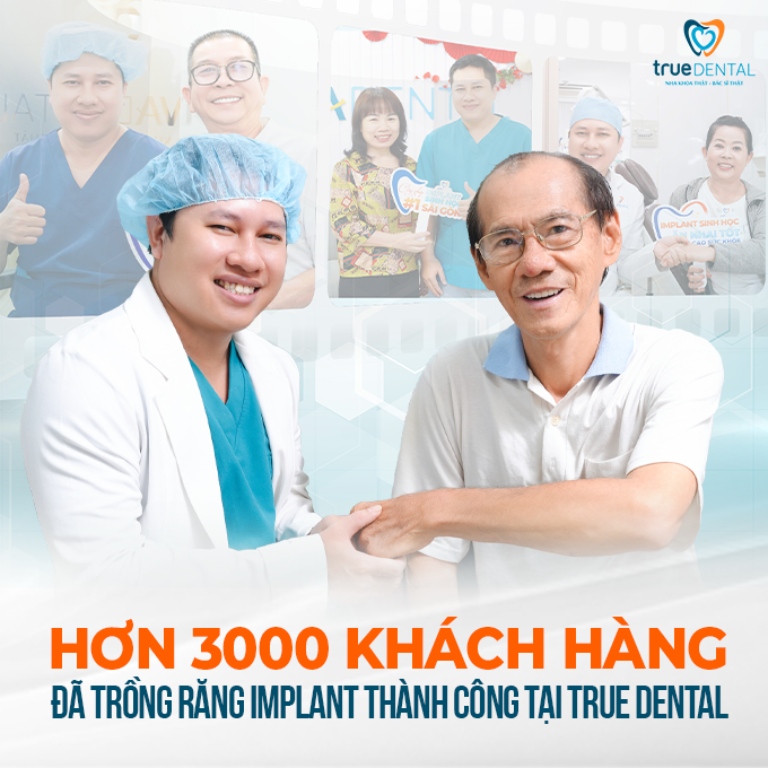 CẮM IMPLANT RĂNG CỬA: QUY TRÌNH THỰC HIỆN VÀ NHỮNG ĐIỀU CẦN BIẾT 4 True Dental - Địa chỉ trồng implant răng cửa công nghệ cao tại TPHCM