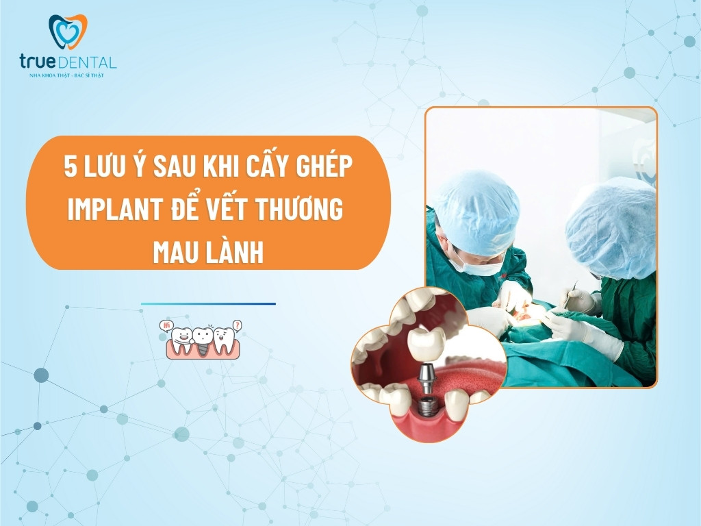 5 LƯU Ý SAU KHI CẤY GHÉP IMPLANT ĐỂ VẾT THƯƠNG MAU LÀNH 1 5 LƯU Ý SAU KHI CẤY GHÉP IMPLANT ĐỂ VẾT THƯƠNG MAU LÀNH