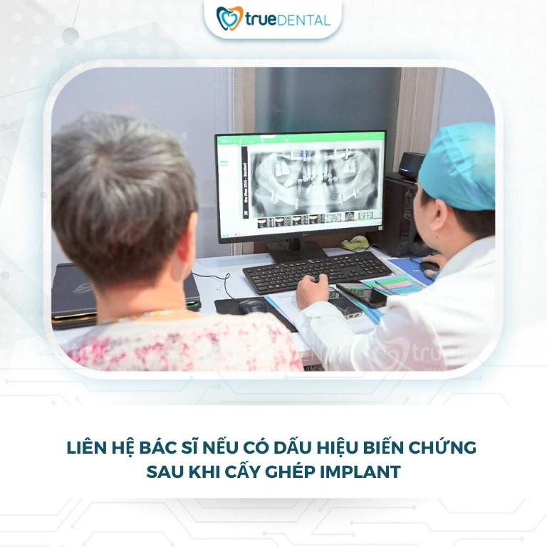5 LƯU Ý SAU KHI CẤY GHÉP IMPLANT ĐỂ VẾT THƯƠNG MAU LÀNH 3 lưu ý khi gặp biến chứng sau khi cấy ghép Implant