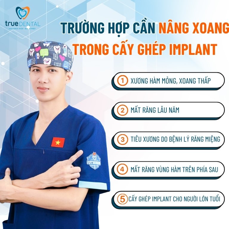 TRƯỜNG HỢP NÀO CẦN NÂNG XOANG HÀM TRONG CẤY GHÉP RĂNG IMPLANT? 3 Trường hợp cần nâng xoang hàm trong cấy ghép Implant