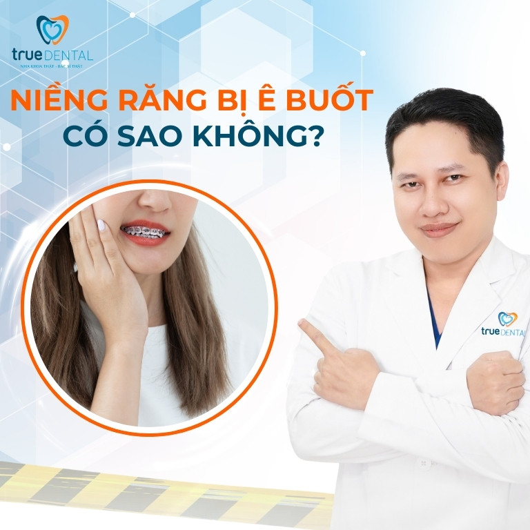 NIỀNG RĂNG BỊ Ê BUỐT CÓ SAO KHÔNG? CÁCH GIẢM Ê RĂNG HIỆU QUẢ 1 niềng răng bị ê buốt có sao không?
