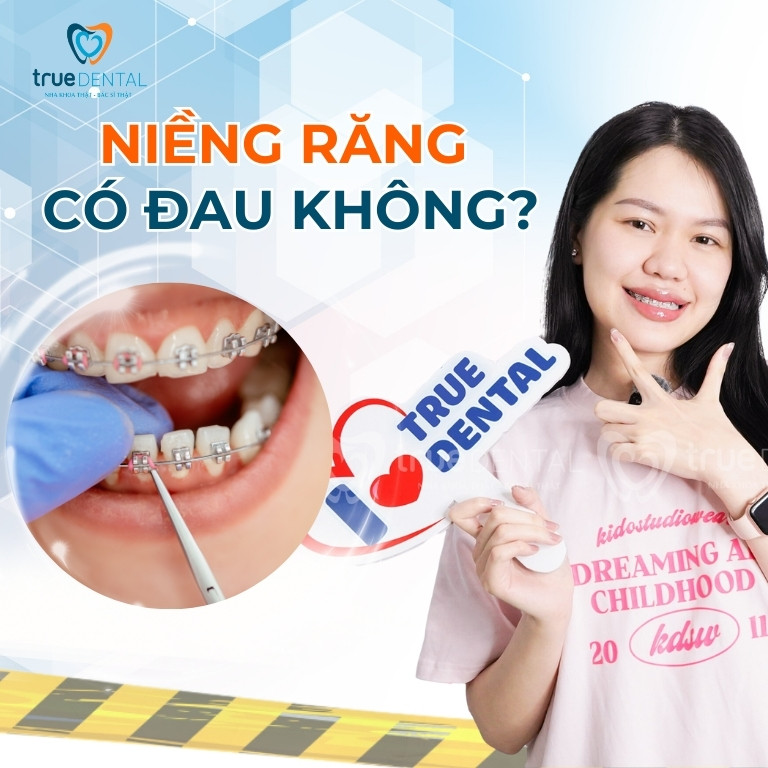 NIỀNG RĂNG CÓ ĐAU KHÔNG? GIAI ĐOẠN ĐAU NHẤT VÀ CÁCH GIẢM ĐAU 2 Niềng răng có đau không?