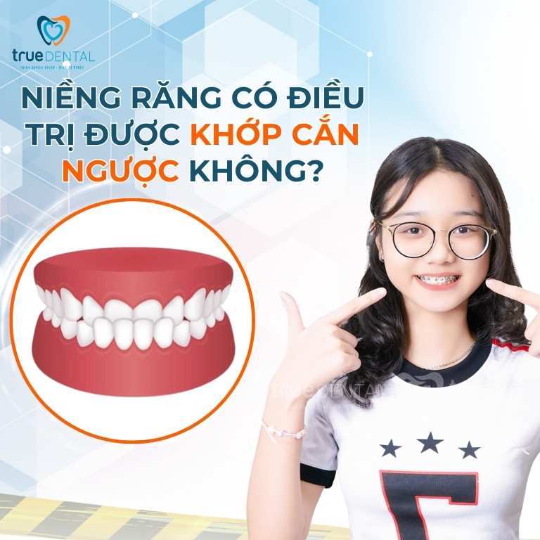 NIỀNG RĂNG KHỚP CẮN NGƯỢC VÀ NHỮNG ĐIỀU BẠN CẦN BIẾT 3 Niềng răng có điều trị được khớp cắn ngược không?