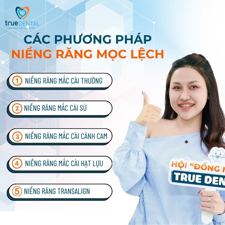 NIỀNG RĂNG MỌC LỆCH LẠC BẰNG PHƯƠNG PHÁP NÀO HIỆU QUẢ NHẤT 4 Các phương pháp niềng răng mọc lệch lạc