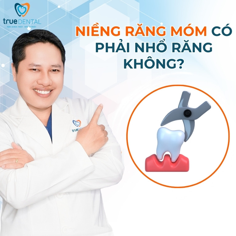 NIỀNG RĂNG MÓM CÓ HIỆU QUẢ KHÔNG? BAO LÂU THÌ HẾT MÓM 3 Niềng răng móm có phải nhổ răng không?