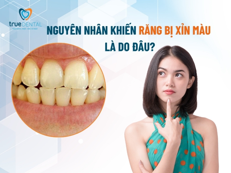 RĂNG BỊ XỈN MÀU DO ĐÂU? NGUYÊN NHÂN, CÁCH PHÒNG NGỪA VÀ KHẮC PHỤC 2 nguyên nhân khiến răng bị xỉn màu