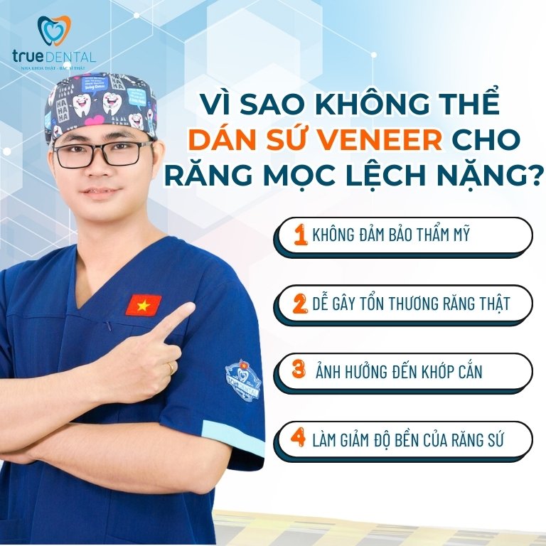 Vì sao không thể dán sứ Veneer cho răng mọc lệch nghiêm trọng?